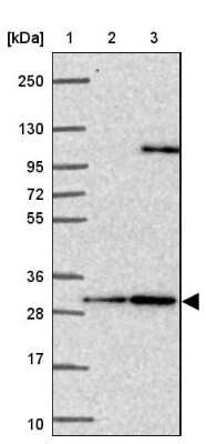 Western Blot: Calbindin D-28K Antibody [NBP2-38798]