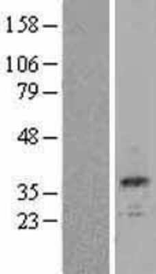 Western Blot: Calbindin D-28K Overexpression Lysate [NBL1-08640]