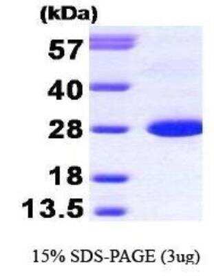 SDS-PAGE: Recombinant Human Calbindin D-28K Protein [NBP1-30222]