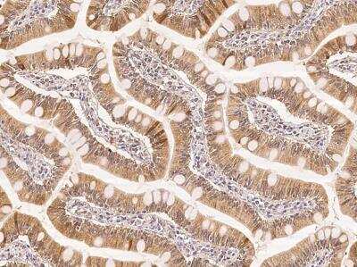 Immunohistochemistry-Paraffin: Calbindin D/S100G Antibody [NBP3-12718]