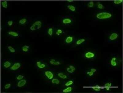Immunocytochemistry/ Immunofluorescence: Calcineurin A Antibody (2G8) [H00005530-M03]
