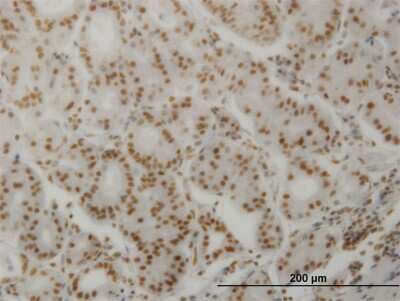 Immunohistochemistry-Paraffin: Calcineurin A Antibody (2G8) [H00005530-M03]
