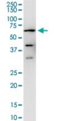 Western Blot: Calcineurin A Antibody (2G8) [H00005530-M03]