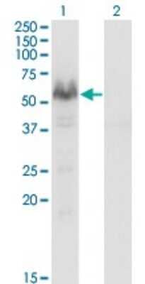 Western Blot: Calcineurin A Antibody (2G8) [H00005530-M03]