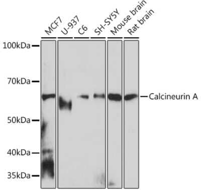 Western Blot: Calcineurin A Antibody (5I6H8) [NBP3-16381]