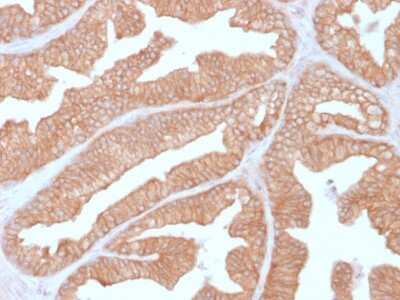 Immunohistochemistry-Paraffin: Calcineurin A Antibody (CALNA/2353) - Azide and BSA Free [NBP3-08395]