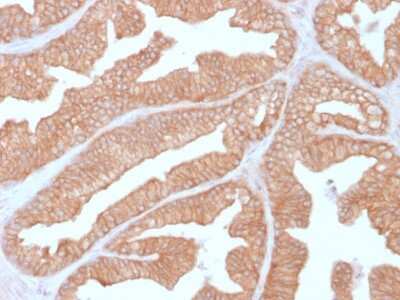 Immunohistochemistry-Paraffin: Calcineurin A Antibody (CALNA/2353) [NBP3-07658]
