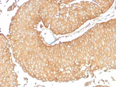 Immunohistochemistry-Paraffin: Calcineurin A Antibody (CALNA/2353) [NBP3-07658]