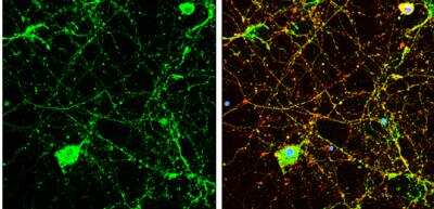 Immunocytochemistry/ Immunofluorescence: Calcineurin A Antibody [NBP1-33041]