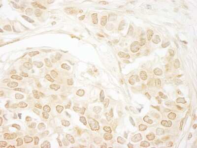 Immunohistochemistry-Paraffin: Calcineurin A Antibody [NB110-40552]