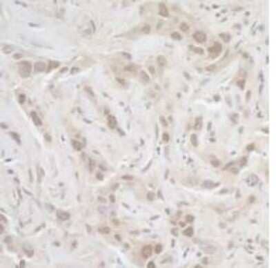 Immunohistochemistry-Paraffin: Calcineurin A Antibody [NB110-40553]