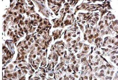 Immunohistochemistry-Paraffin: Calcineurin A Antibody [NBP1-33041]