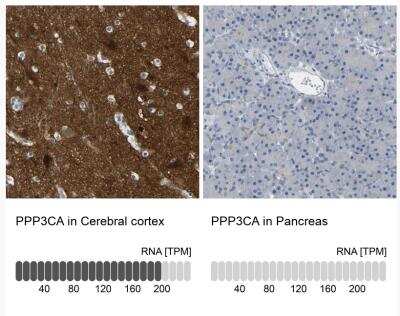 Immunohistochemistry-Paraffin: Calcineurin A Antibody [NBP1-88218]