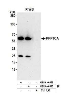 Immunoprecipitation: Calcineurin A Antibody [NB110-40553]