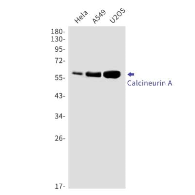 Western Blot: Calcineurin A Antibody (S01-6F5) [NBP3-19843]