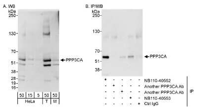 Western Blot: Calcineurin A Antibody [NB110-40552]