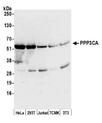 Western Blot: Calcineurin A Antibody [NB110-40553]