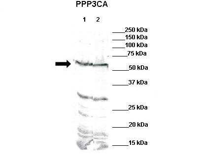 Western Blot: Calcineurin A Antibody [NBP1-57844]