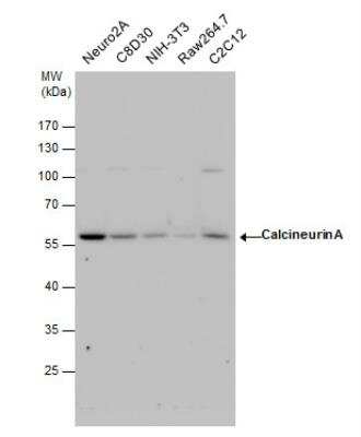 Western Blot: Calcineurin A Antibody [NBP2-15663]
