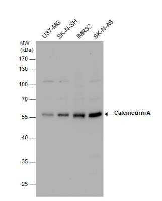 Western Blot: Calcineurin A Antibody [NBP2-15663]