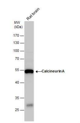 Western Blot: Calcineurin A Antibody [NBP2-15663]