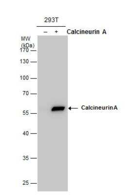 Western Blot: Calcineurin A Antibody [NBP2-15663]