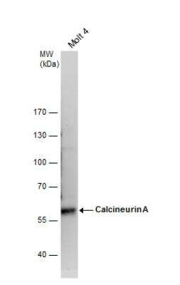 Western Blot: Calcineurin A Antibody [NBP2-15663]