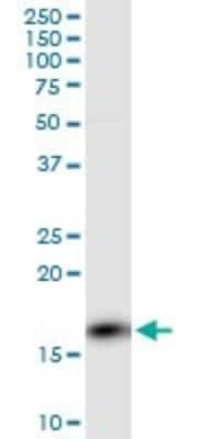 Western Blot: Calcineurin B Antibody (4E1) [H00005534-M01]