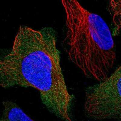 Immunocytochemistry/ Immunofluorescence: Calcineurin B Antibody [NBP2-46745]