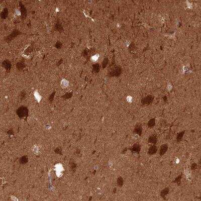 Immunohistochemistry-Paraffin: Calcineurin B Antibody [NBP2-46745]