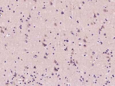 Immunohistochemistry: Calcineurin B Antibody [NBP2-99441]