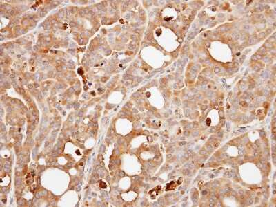 Immunohistochemistry-Paraffin: Calcineurin B Antibody [NBP1-32720]