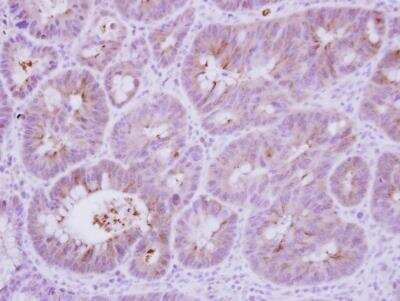 Immunohistochemistry-Paraffin: Calcineurin B Antibody [NBP2-15664]