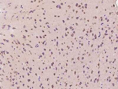 Immunohistochemistry-Paraffin: Calcineurin B Antibody [NBP2-99441]