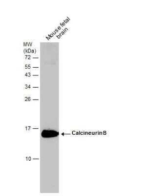 Western Blot: Calcineurin B Antibody [NBP1-32720]