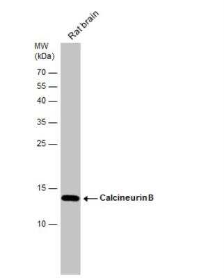 Western Blot: Calcineurin B Antibody [NBP1-32720]