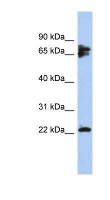 Western Blot: Calcineurin B Antibody [NBP1-56816]