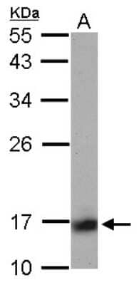 Western Blot: Calcineurin B Antibody [NBP2-15664]