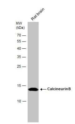 Western Blot: Calcineurin B Antibody [NBP2-15664]