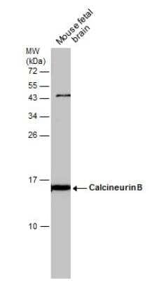 Western Blot: Calcineurin B Antibody [NBP2-15664]