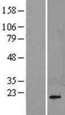 Western Blot: Calcineurin B Overexpression Lysate [NBL1-14707]