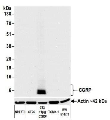 Western Blot: Calcitonin Antibody (BLR169J) [NBP3-14743]