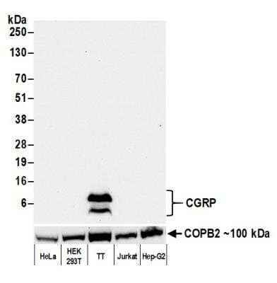 Western Blot: Calcitonin Antibody (BLR169J) [NBP3-14743]