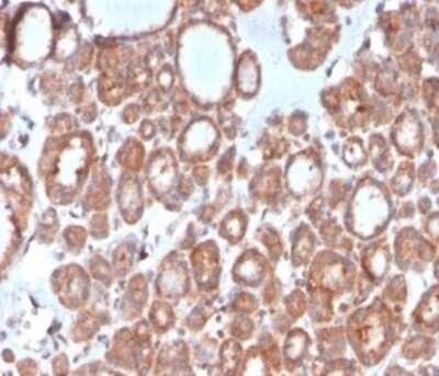 Immunohistochemistry-Paraffin: Calcitonin Antibody (CALCA/3310) [NBP3-13800]