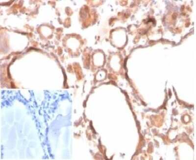 Immunohistochemistry-Paraffin: Calcitonin Antibody (CALCA/3310) [NBP3-13800]