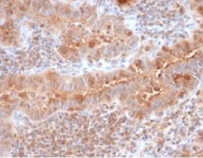 Immunohistochemistry-Paraffin: Calcitonin Antibody (CALCA/3310) [NBP3-13800]