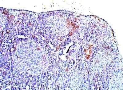 Immunohistochemistry-Paraffin: Calcitonin Antibody [NBP3-12293]
