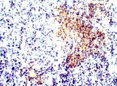 Immunohistochemistry-Paraffin: Calcitonin Antibody [NBP3-12293]