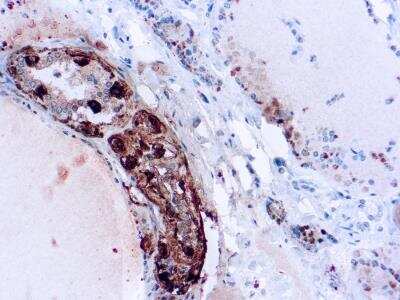 Immunohistochemistry-Paraffin: Calcitonin Antibody (SP17) [NBP2-26483]