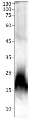 Western Blot: Calcitonin Antibody [NBP3-12261]